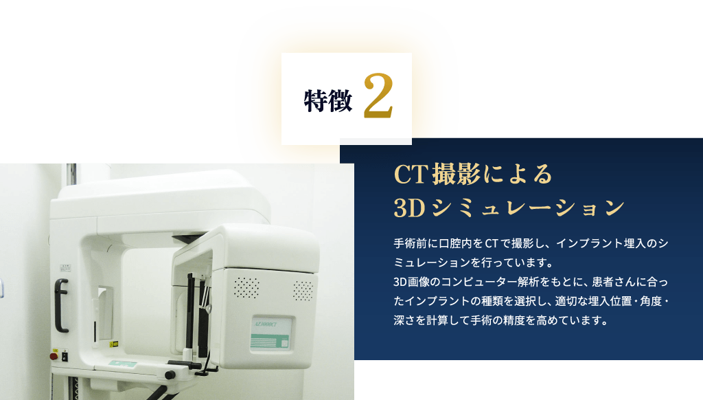 特徴2 CT撮影による3Dシミュレーション